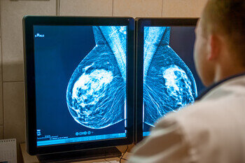 Cancer screening programmes, a long road back to normal