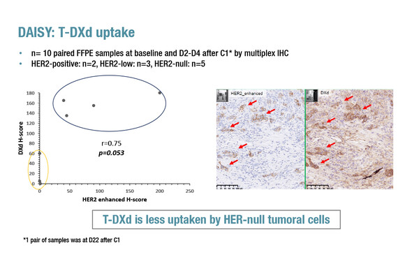 LBA1_ESMO Breast 2022